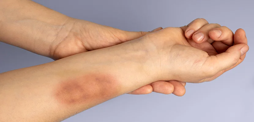 Louisiana Aggravated Assault & Battery Lawyer-image