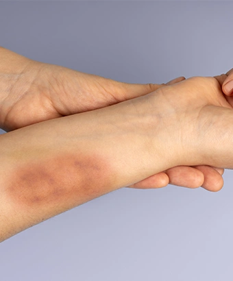 Aggravated Assault & Battery Image Image